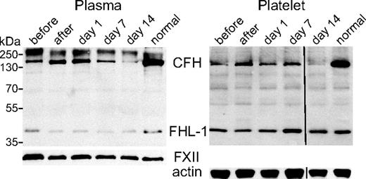 Figure 5. Plasma and platelet CFH content in response to plasma transfusion in a constitutive CFH-null patient treated with plasma transfusion. Immunoblots (nonreduced 10% sodium dodecyl sulfate–polyacrylamide gel electrophoresis) of equivalent plasma aliquots (left) and platelet lysates (right) from a normal person (lane “normal”) and aHUS patient 1 lacking constitutive expression of CFH (but capable of expressing FHL-1) tested before therapeutic plasma transfusion (lane “before”), after treatment (lane “after”), and after treatment at days 1, 7, and 14 (corresponding lanes; transfusion interval was 14 days). Loading was equivalent to 0.7 μL of plasma and lysate from 107 platelets per lane. Immunoblots were initially probed with a rabbit polyclonal antibody capable of detecting CFH and FHL-1, and subsequently with antibodies specific for coagulation FXII for the plasma blot, and β-actin for the platelet lysate blot as loading controls. CFH is deficient in plasma and platelets before (lane “before”) and on day 14 (lane “day 14”) compared with a normal person (lane “normal”), whereas FHL-1 levels were unchanged. CFH levels were highest right after transfusion (lane “after”) and then declined over the following 14 days (lanes “day 1,” “day 7,” and “day 14”) in both plasma (left panel) and platelets (right panel). A vertical line has been inserted in the right panel (“Platelet”) to indicate a repositioned gel lane.