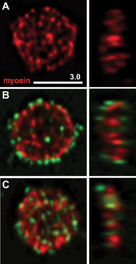 Figure 6. Uptake of labeled CFH by normal washed platelets. Triple-washed platelets were incubated with or without CFH conjugated with Alexa Fluor 488 dye (A488-CFH, green color), then fixed, immunostained for platelet myosin IIA (myosin), and examined via laser fluorescence confocal microscopy. Midcell Z-slices of typical resting cells (flat, round shape with myosin staining in red) are shown in horizontal (left) and vertical (right) orientation. Platelets shown were incubated: (A) for 120 minutes in buffer; (B) with A488-CFH for 30 minutes; (C) with A488-CFH for 120 minutes. After 30 minutes, most of the platelet-associated A488-CFH was on the cell surface as indicated by peripheral staining; after 120 minutes, a substantial amount was observed inside platelets.