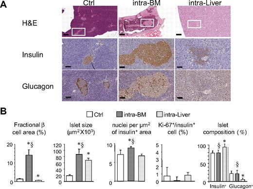 Figure 6. Graft morphology. (A) Histologic appearance (top, ×5; scale bar, 400 μm; bottom, ×20; scale bar, 100 μm) of islets in control pancreas, BM, and liver 1 year after transplantation. (B) Fractional β-cell area, islet size, islet composition, β-cell proliferation, and nucleus density of insulin-positive area in mice reaching normoglycemia after islet transplantation in BM (n = 6) and liver (n = 6) 1 year after islet infusion, and in the pancreas of control mice (n = 6). Data are expressed as mean ± SD. Statistical analysis was performed using 1-way ANOVA test, followed by Bonferroni post hoc t test. *P < .01 versus control; §P < .05 versus intraliver.