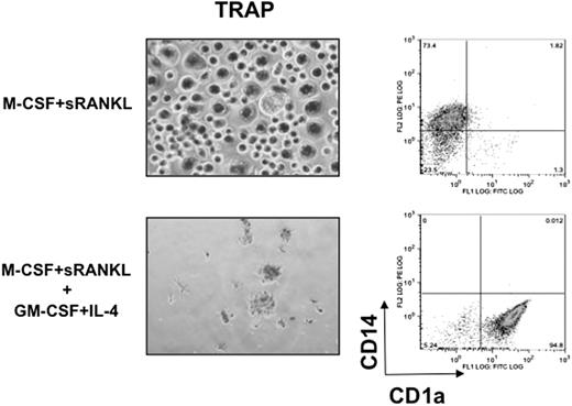 Figure 1. GM-CSF and IL-4 in combination abolish osteoclastogenesis while inducing formation of immature DCs. Monocytes were cultured in the presence of M-CSF and sRANKL (top panels). GM-CSF and IL-4 in combination were added to the monocytic cultures together with M-CSF and sRANKL (bottom panels) with replacement of half of the medium and addition of the cytokines every 3 days. The cells were stained for TRAP at day 14 (left panels), and cell surface CD1a and CD14 expression was analyzed at day 5 by flow cytometry.