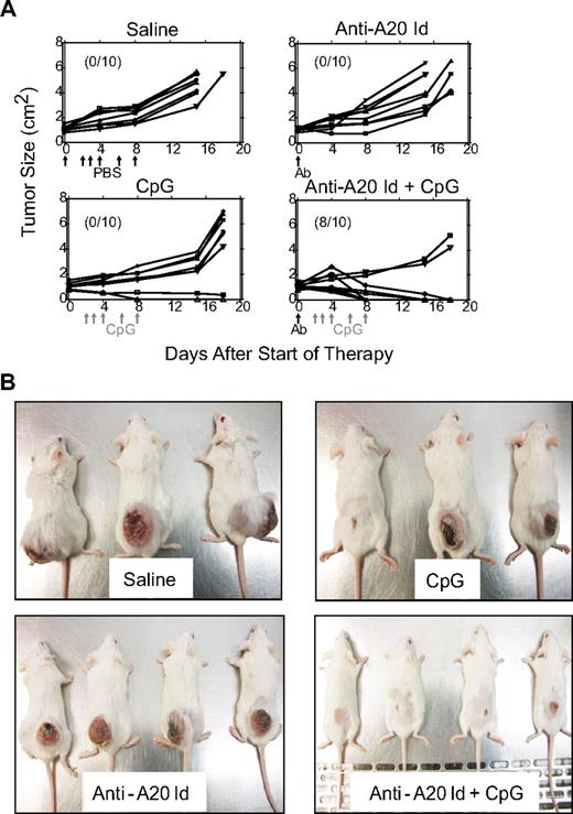 Figure 4. Anti-A20 Id mAb + CpG combination therapy can cure large established A20 tumors. (A) Balb/c mice were inoculated with 107 A20 cells subcutaneously. Therapy began when tumors were 1 cm2 (day 0; as indicated by the arrows). Anti-A20 Id mAb was administered intraperitoneally on day 0, and CpG was administered intratumorally on days 2, 3, 4, 6, and 8 (P < .001). Numbers in parentheses indicate animals cured by therapy. (B) Photographs were taken of mice (on day 15) shown in panel A demonstrating that anti-A20 Id mAb + CpG combination therapy was superior to CpG or antibody alone in curing mice of large established tumors. The mice in each panel are representative of the group from which they are taken.