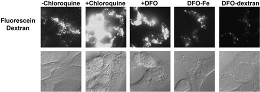 Figure 4. DFO does not induce pH changes in the lysosome. HeLa cells were incubated with fluorescein dextran for 6 hours and then incubated in the absence of dextran for 2 hours. Cells were then incubated with or without chloroquine, DFO, DFO saturated with iron (DFO-Fe), or DFO-dextran. Images were acquired on an epifluorescence microscope. The data are representative images from each condition found in 3 separate experiments.