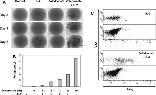 Figure 5. Zoledronate and IL-2 promote cellular responses in the CD56+ subset in a synergistic, time- and dose-dependent fashion. (A) CD56+ cells (106/mL) were either left untreated or stimulated with IL-2, zoledronate, or zoledronate plus IL-2 in round-bottomed 96-well plates. Microscopic monitoring of cell cultures from day 3 to day 5 showed cell aggregation as an indicator of cell activation. (B) CD56+ cells (106/mL) were stimulated with IL-2 at 100 U/mL and increasing concentrations of zoledronate. IFN-γ levels determined in culture supernatants on day 5 increased in a dose-dependent fashion (mean values of duplicate cultures). (C) CD56+ cells (1.5 × 106/mL) were stimulated for 72 hours with either IL-2 alone (100 U/mL) or with zoledronate (2 μM) plus IL-2. Staining of surface Vδ2 and intracellular IFN-γ showed that Vδ2+ cells produced IFN-γ in response to zoledronate plus IL-2 but not in response to IL-2 alone.