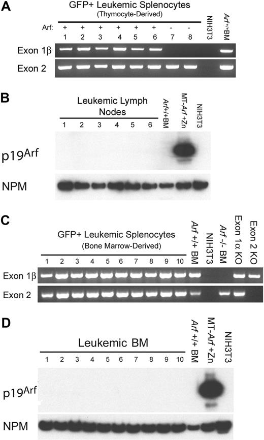 Figure 5. T-ALLs arising from cultured ICN1+ Arf +/+ donor cells retain the gene but do not express p19Arf protein. (A) Leukemic GFP+ splenocytes from 8 mice that had received cultured (day-12) thymocyte-derived donor cells of the indicated Arf genotypes (top) were purified by FACS. Genomic DNA prepared from these cells was used as a template for PCR performed with primers specific for exon-1β and exon-2 of the Ink4a-Arf locus. Exon-1β encodes the unique N-terminus of p19Arf, whereas exon-2 encodes C-terminal portions of p19Arf and p16Ink4a from alternative reading frames. DNAs extracted from unmanipulated Arf +/+ bone marrow cells and from mouse NIH-3T3 cells that had deleted the Ink4a-Arf locus during the process of immortalization were used as the positive and negative controls, respectively. The fact that no exon-1β signal was revealed in samples 7 and 8 generated from Arf −/− donor cells indicates that the purified leukemic cells were uncontaminated by normal Arf +/+ cells. (B) Although all genotyped leukemias retained the Arf locus, immunoblotting of electrophoretically separated proteins extracted from robustly GFP-positive lymph nodes taken from the same recipients of Arf +/+ donor cells failed to reveal p19Arf expression. Arf expression is also silenced in normal bone marrow (BM) cells. Cells engineered to express Arf conditionally under the control of a metallothionein promoter (MT-Arf cells) were induced with zinc. The immunoblot was developed with a highly sensitive monoclonal antibody generated to mouse p19Arf (Bertwistle et al34), and the film was purposely overexposed in an attempt to reveal p19Arf expression. Nucleophosmin (NPM), an abundant nucleolar protein, was used as the loading control. (C) PCR analysis as in panel A. Samples 1 to 4 were taken from irradiated recipients that had received a transplant of uncultured ICN1-expressing bone marrow from 5-FU–conditioned donors. Samples 5 to 10 were taken from nonirradiated recipients that had received 5-FU–conditioned bone marrow transduced with ICN1 and cultured on OP9 stroma before their adoptive transfer. Control PCR reactions were performed using DNAs extracted from unmanipulated Arf +/+ bone marrow cells, NIH-3T3 cells lacking the Ink4a-Arf locus, bone marrow cells from Arf −/− mice in which exon-1β is disrupted, bone marrow cells from p16Ink4a-null mice in which the unique Ink4a exon-1α was disrupted, and from mice in which Ink4a-Arf exon-2 was disrupted. (D) Immunoblotting for p19Arf was performed on bone marrow taken from the mice analyzed in panel C.