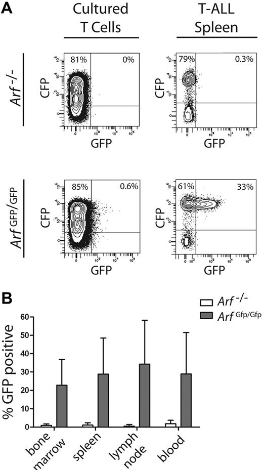 Figure 6. Activation of the Arf promoter during T-ALL development. Healthy syngeneic C57BL/6 mice received donor T cells derived from either control Arf −/− or “knock-in” Arf Gfp/Gfp (also functionally null) thymocytes infected with an ICN1-CFP vector. (A) Cells from day-12 cultured thymocytes (left panels) or from spleens of moribund mice (right panels) were studied by FACS for coexpression of vector-coded CFP (ordinate) and cellular Arf-encoded GFP (abscissa). (B) Hematopoietic tissues from 17 such mice were similarly analyzed and contained a significant proportion of CFP-marked cells that coexpressed GFP (ordinate). Error bars indicate the SD from the mean.