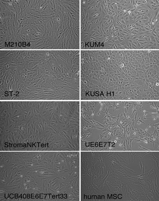 Figure 1. Phenotype of the different MSCs. Figure displays phase-contrast photomicrographs that depict the morphologic appearance of MSC lines and primary MSCs derived from the marrow of a patient with CLL. Cells were imaged in medium using a phase-contrast microscope (Model ELWD 0.3; Nikon) with a 10 × /0.25 NA objective lens. Images were captured with a Nikon D40 digital camera (Nikon Corp) with the use of Camera Control Pro software (Nikon); when necessary, Adobe Photoshop 9.0 (Adobe Systems) was used for image processing.