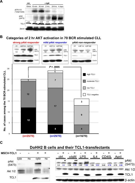 Figure 2. Higher TCL1 levels predict the degree of BCR-induced AKT phospho-activation in CLL short-term cultures. (A) After BCR crosslinking, responsive CLL cases showed rapid ERK1/2 phospho-activation followed by variable and usually prolonged pS473-AKT induction. pAKT activation could be detected in some cases by 15 minutes of BCR stimulation and was most variable between cases at 2 hours, peaked between 24 to 48 hours, and declined thereafter. Such responsive cases frequently showed parallel changes in TCL1 levels (see also Table 1). (B) Using 3 different α-IgM plate concentrations for each of the 70 CLL cultures, the degree of AKT phospho-activation after 2 hours of BCR engagement (graded as none, moderate, or strong) was highly correlated with TCL1 levels (P = .005, graded as in Figure 1). Among the strong pAKT responder group (red text), moderate to high TCL1 levels were seen in 24 of 25 cases, whereas 75% of the TCL1-dim/negative cases were in the nonresponsive group (black). A third group of cases showed moderate levels of pAKT induction, even at high α-IgM concentrations (blue, middle panel). (C) Full-length TCL1, introduced into the TCL1-negative DoHH2 B-cell line, showed both cytoplasmic and nuclear localization with most pAKT phospho-activation in the cytoplasmic fraction (left panel). TCL1 introduction led to mildly increased (1.26-fold) basal pAKT levels, compared with the TCL1− baseline (“*” in right panel) but more prominent phospho-activation after BCR (**1.72-fold after TCL1+ baseline was set as 1.0) or LPS stimulation, but not after other B-cell cytokine stimuli. Numbers indicate normalized densitometric quantitation of blot, with 1.0 corresponding to the level seen in the unstimulated control condition (blue indicates TCL1-expressing transfectants).