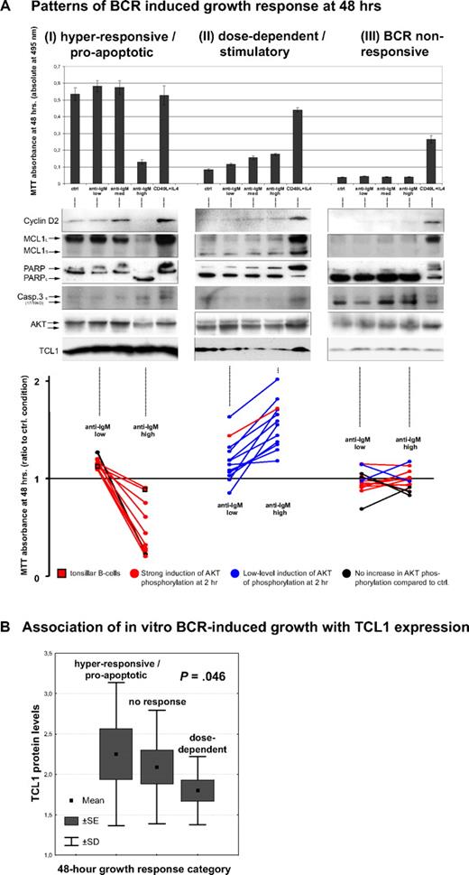 Figure 3. The growth response in CLL cultures after BCR engagement is most strongly predicted by pAKT activation and by TCL1 levels. (A) The growth and apoptotic parameters of 29 CLL cultures from Figure 2B were measured after 48 hours of continuous BCR crosslinking at 3 different α-IgM concentrations, compared with CD40/IL-4 stimulation and unstimulated controls. Cases were defined as having a hyperresponsive BCR pattern (left panels, with growth at low α-IgM and apoptosis at higher doses), dose-dependent BCR response (center panels), or absent growth response (right panels) based on MTT assay (top panels) and immunoblots (middle panels). Increased cyclin D2 levels correlated with MTT-measured growth induction as did expression of the AKT target MCL1, whereas cleaved PARP and caspase 3 levels correlated with the degree of apoptosis observed. The 2-hour AKT phospho-activation pattern after BCR engagement (colored as in Figure 2B as follows: red, strong; blue, moderate; and black, absent) were correlated with the 48-hour growth pattern (bottom panel). Cases with a hyperresponsive growth pattern showed strong pAKT induction (red lines) that paralleled the BCR response pattern seen in tonsillar B cells (lines with square boxes), whereas cases with only moderate BCR induced pAKT activation showed dose-dependent growth patterns (blue lines). (B) The pattern of BCR-inducible growth at 48 hours correlated with TCL1 levels. A hyperresponsive/apoptotic outcome was seen in CLLs with the highest TCL1 expression, whereas a lower level but progressive increase of growth on α-IgM escalation (dose-dependent response) was associated with low to moderate TCL1 levels in most cases. CLL cultures not responding to BCR stimulation included those that were negative/low for TCL1 but also some that highly expressed TCL1 where the growth stimulation may have been missed because of timing of the MTT assay.