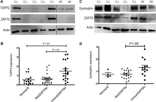 Figure 5. Elevated TAPP2 and syntrophin expression in the ZAP70+, IgH unmutated subset of B-CLL patients. Protein extracts of B-CLL (CLL) or normal human B cells (NB) were made using NP-40 lysis buffer, and 5 μg of protein per sample was run on SDS-PAGE gels. (A) TAPP2, ZAP70, or actin expression was detected by Western blot. Blots are representative of > 40 samples analyzed (each sample examined in at least 2 independent experiments). (B) Chemiluminescence signals for TAPP2, ZAP70, and actin blots were quantified using a Fluorchem instrument. Data are normalized to the actin signal for each sample. Graphs represent the normalized expression of 41 CLL and 15 normal B-cell samples, and CLL samples were divided into IgH unmutated/ZAP70+ and IgH mutated/ZAP70− groups. P values were calculated using a Mann-Whitney test comparing the indicated groups. (C) Representative Western blot showing syntrophin expression in CLL and normal B cells. (D) Quantitative analysis of syntrophin expression in normal B cells, and unmutated/ZAP70+ and IgH mutated/ZAP70− CLL groups.