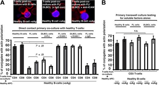 Figure 2. Follicular lymphoma and DLBCL cells induce defective immune synapse formation in previously healthy T cells via direct contact interaction. (A) Healthy T cells were cocultured in direct contact for 24 hours with either healthy allogeneic B cells or allogeneic FL or transformed DLBCL (t-FL) and subsequently used in conjugation assays with sAg-pulsed third-party allogeneic healthy donor B cells (APCs, blue). Conjugates were selected at random for imaging and were scored for polarization of F-actin (red) at the immune synapse. Note the prevention of the synapse defect when cell adhesion was blocked by pretreatment of FL or DLBCL cells with anti–ICAM-1 monoclonal antibody before primary coculture with healthy T cells but not with isotype control antibody treatment (IgG). Data are the mean ± SD from 9 independent experiments with at least 50 conjugates analyzed per experiment. The confocal images shown are CD8+ T cells. (B) Healthy T cells cocultured for 48 hours with either healthy allogeneic B cells or allogeneic FL or DLBCL cells in transwell culture plates and subsequently used in conjugation assays with ± sAg-pulsed third-party allogeneic healthy donor B cells (APCs). Conjugates were selected at random for imaging and were scored for accumulation of F-actin at the immune synapse. Data are the mean ± SD from 9 independent experiments with 50 conjugates analyzed per experiment.