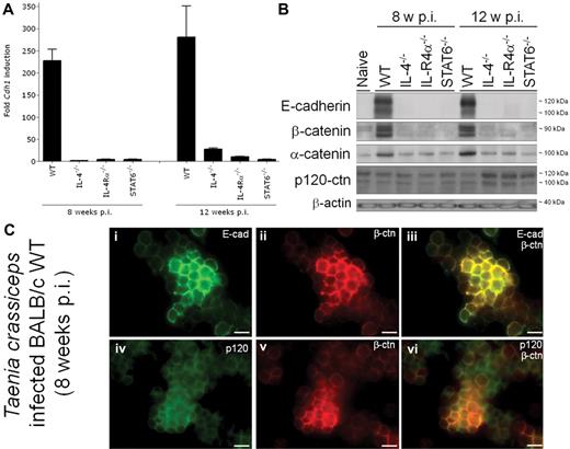 Figure 5. The E-cadherin/catenin complex is induced in peritoneal alternatively activated macrophages elicited during T crassiceps infection. PEMs were isolated from BALB/c WT, IL-4−/−, IL-4Rα−/−, and STAT6−/− uninfected mice or 8 and 12 weeks after T crassiceps infection. (A) The fold Cdh1 induction relative to the expression in PEMs from the corresponding uninfected mice (= 1) is shown. (B) Peritoneal macrophages were analyzed by immunoblotting using antibodies against E-cadherin, β-, α- or p120-catenin. β-Actin was applied as a loading control. (C) Immunofluorescence microscopy on peritoneal macrophages isolated from T crassiceps infected WT BALB/c mice (8 weeks after infection). PEMs were grown on glass coverslips and after E-cadherin (i), β-catenin (ii,v), or p120-catenin (iv) labeling; images were obtained using an Olympus CellM fluorescence microscope. Subpanels iii and vi are merged pictures of the respective green and red images. Scale bars represent 20 μm.