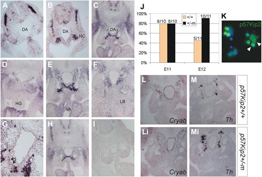 Figure 4. p57Kip2 expression and function in the AGM. Analysis of p57Kip2 expression by in situ hybridization in E9 wild-type (A-B), E11 wild-type (C-H), and E11 p57Kip2+/−m (I) embryos. (D) Caudal section; (F) rostral section. (G) Close-up of an E11 aorta with endothelial expression highlighted by arrows and subaortic expression with an asterisk. Stained sections were mounted with Hydromount. Ventral, down. DA indicates dorsal aorta; HG, hindgut; LB, lung bud; NC, nephrogenic chord; and VA, vitelline artery. (J) Graph showing percentage of mice repopulated with E11 and E12 AGMs (1 ee) from wild-type or p57Kip2 mutant embryos. The number of repopulated mice/total mice injected is indicated above each bar. (K) Cytospin of E11 AGM cells stained with an antibody for p57Kip2 (green, Alexa488) and mounted with Vectashield. Nuclear 4,6 diamidino-2-phenylindole staining in blue. White arrowheads indicate cells with cytoplasmic p57Kip2. Expression analysis by in situ hybridization for Cryab (L,Li) and Th (M,Mi) on wild-type (L-M) and p57Kip2+/−m (Li,Mi) E11 embryos. Stained sections were mounted with Hydromount (National Diagnostics). All pictures were taken with a Zeiss AxioSkop2 Wide-Field Microscope fitted with a Zeiss AxioCam MRc5, and images analyzed with the Zeiss AxioVision software (all from Carl Zeiss Ltd). Objectives used were 5×/0.15 NA (C,H-I), 10×/0.25 NA (A-B,D-F,L,Li,M,Mi), 20×/0.45 NA (G), and 40×/0.65 NA (K).