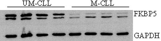 Figure 1. WB analysis of FKBP5 expression in CLL cells.