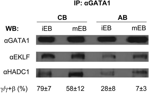 Disclosures: No relevant conflicts of interest to declare.