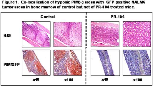 Figure 1. Co-localization of hypoxic PIM(+) areas with GFP positive HALMG tumor areas in bone marrow of control but not of PR-104 treated mice.