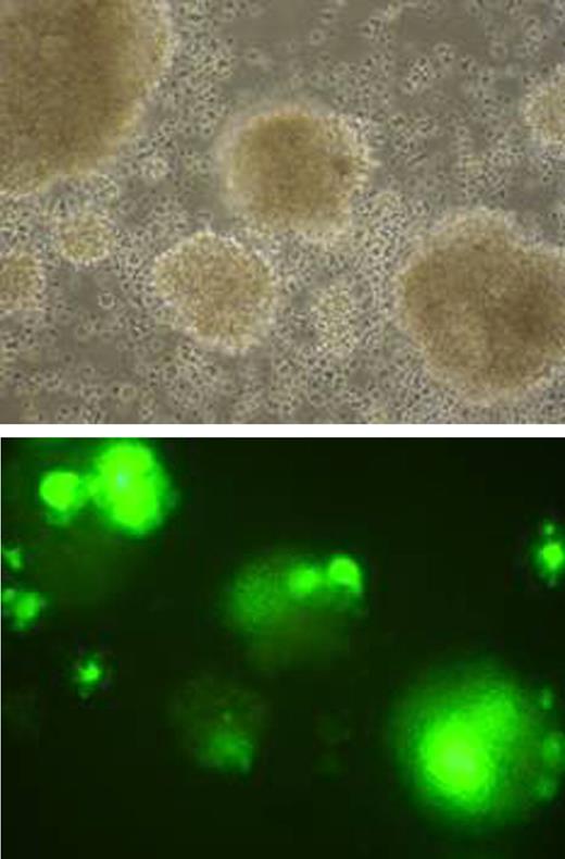 Figure 1. MV-Edm infection results in prominent syncytia formation in primary ALL cells (A and B).