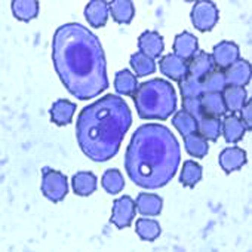 Fig.1. May Grumwal-Giemsa staining inverted microscope analysis.