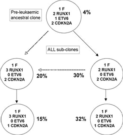 Figure 1. Sub-clones present in diagnostic sample before intratibial injection into NOD/SCID/IL2Rgamma(null) mice, assayed by 3 colour FISH for the ETV6-RUNX1 gene fusion, ETV6 deletion, RUNX1 gain and CDKN2A deletion. All four leukaemic subclones were present in the mice after leukaemic engraftment at 10 -12 weeks, but with the CDKN2A deleted sub-clones predominant.