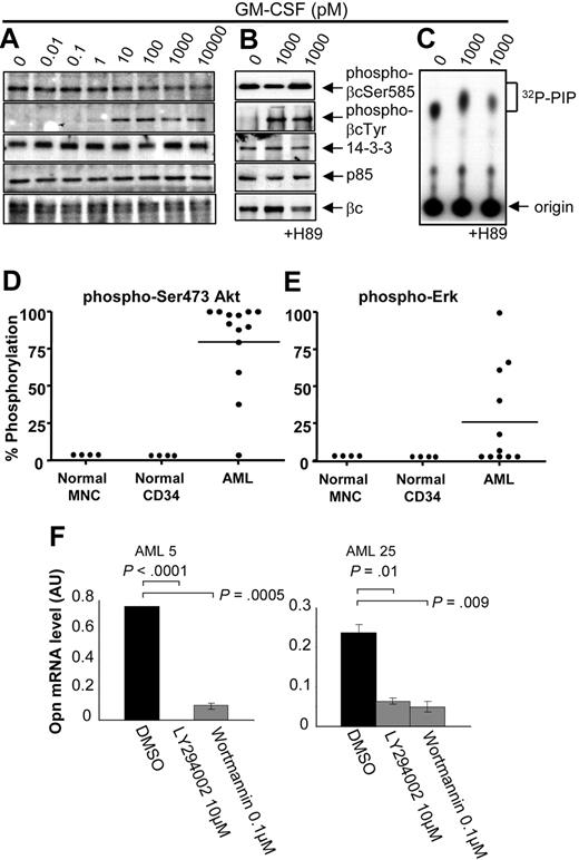 Figure 5. AML blasts exhibiting constitutive Ser585 phosphorylation also show deregulated PI3-kinase signaling. Mononuclear cells from patients with AML (A, AML37; B-C, AML101) were stimulated with the indicated concentrations of GM-CSF for 5 minutes. Where indicated, cells were preincubated for 1 hour with 10μM H89 or DMSO vehicle control before GM-CSF stimulation. Cells were then lysed and βc immunoprecipitated and subjected to SDS-PAGE and immunoblot analysis with the indicated antibodies. (C) In vitro kinase assay for PI3-kinase activity was performed on βc immunoprecipitates with phosphatidyl inositol 4,5 phosphate (PIP) and 32Pγ-ATP as described in “Cytokine signaling.” 32P-PIP and the origin are indicated (C). Whole-cell lysates were blotted with anti–phospho-Ser473Akt (D) or anti–phospho-ERK (E), and signals were quantified by laser densitometry. The level of phosphorylation in the absence of GM-CSF was plotted as a percentage of maximum signal observed after GM-CSF stimulation. (F) Purified CD34+ cells from the indicated AML patient samples were treated with 10μM LY294002 or 0.1μM Wortmannin or DMSO for 24 to 72 hours in IMDM medium containing 0.5% FCS, after which time viable cell number was assessed with Flow-Count Fluorospheres, and total RNA was isolated for OPN quantitative RT-PCR as described in Figure 4D.