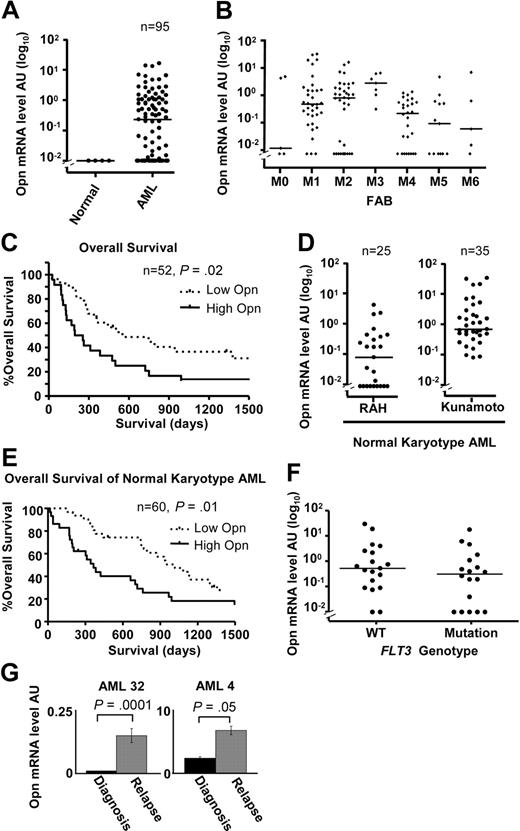 Figure 7. Increased OPN expression is associated with poor OS in AML. (A) Scatterplot showing OPN expression determined by quantitative RT-PCR in 4 normal CD14+ monocyte controls and 95 diagnostic samples from consecutive patients with AML collected at the RAH of which 60 were treated with induction chemotherapy. The horizontal lines indicate the median expression of OPN (0.23 AU). (B) Scatterplot of the range and median of OPN expression for various FAB classifications for all patients analyzed (95 RAH plus 35 Kunamoto normal karyotype patients). There is a significant difference in median OPN expression between FAB M3 and M4 or M5 subgroups (P = 0.01, Kruskal-Wallis test; P < .05, Dunn multiple comparisons test). (C) Kaplan-Meier log-rank analysis of all patients from RAH who underwent standard induction chemotherapy, excluding acute promyelocytic leukemia (APML; M3; n = 52). Taking a cutoff of 0.23 AU (median; split panel A), patients were divided into either high OPN expressers (> 0.23 AU) or low OPN expressers (< 0.23 AU). (D) Scatterplot showing the range and median of OPN expression for cytogenetically normal AML patient samples obtained at RAH (n = 25) and Kunamoto (n = 35), which were analyzed for OS (E). (E) Kaplan-Meier survival curves for the combined patients with normal cytogenetic AML shown in panel D after standard induction chemotherapy (n = 60), comparing high versus low OPN expression as determined by median split of each cohort as shown in panel D. High OPN is associated with poor OS (median, 384 days) compared with low OPN (median, 1017 days; P = .01). (F) Scatterplot comparing OPN expression in patients with cytogenetically normal AML analyzed in panel E for which FLT3 mutation status had been determined (ITD or D835 mutation; n = 37). There was no difference in median OPN expression between the 2 groups (n = 37; P = .2, Mann-Whitney U test). (G) Two patients for whom cryopreserved diagnosis and relapse samples were available were examined for OPN expression by quantitative RT-PCR. A significant increase in OPN expression was observed in both patients at relapse (P < .05, Mann-Whitney U test).