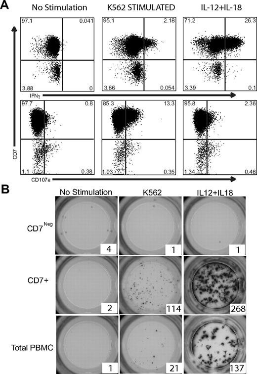 Figure 4. CD7+CD56+ NK cells, but not CD7negCD56+ cells, produce IFNγ in response to K562 target cells or IL-12 + IL-18 stimulation. (A) Intracellular cytokine flow cytometry was performed on total PBMCs after no stimulation or stimulation with K562 target cells or IL-12 + IL-18. CD3/14/19neg cells were gated for CD56 expression. These CD56+ cells were analyzed for IFNγ and CD107a expression in the CD7+ and CD7neg fractions. Only CD7+CD56+ NK cells expressed IFNγ and CD107a after stimulation. One representative example of 6 are shown for IFNγ and CD107a expression. (B) CD7+CD56+ NK cells and CD7negCD56+ monocyte/DC-like cells were sorted by flow cytometry and 1000 of each cell type were plated per well of a precoated anti-IFNγ ELISPOT plate. Cells were cultured either in media alone (not stimulated) or were stimulated overnight with K562 target cells or IL-12 + IL-18. One representative example of 3 experiments is shown.