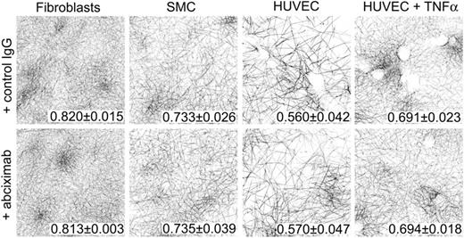 Figure 3. β 3 integrins do not modulate fibrin structure on fibroblasts, SMCs, or HUVECs. In situ thrombin generation was initiated by incubating fibroblasts, SMCs, and HUVECs with recalcified, normal, pooled PFP in the presence of 0.136μM control IgG or anti-β3 antibody (abciximab) as described in “Methods.” Three-dimensional projections show clot architecture in 10-μm stacks 0 to 10 μm from the cell surface. Each image (146 μm × 146 μm, xy) is from 1 experiment, representative of 2 to 5 separate experiments. Data (no. fibers/point, ± SD) indicate mean fibrin network density from all experiments. Fibrin density in clots formed in the presence of control IgG or abciximab was not statistically different.
