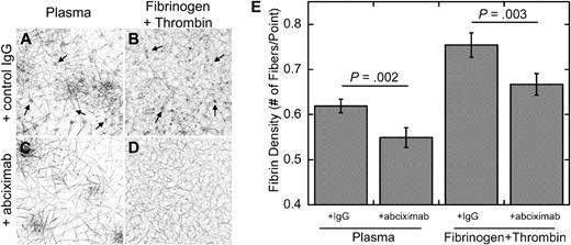 Figure 4. β 3 integrins modulate fibrin structure on platelets. (A,C) Clotting was initiated on platelets with the addition of recalcified, normal, pooled PFP to lipidated TF (1:120 000, final), in the presence of 0.136μM control IgG (A) or the anti-b3 Fab abciximab (C). (B,D) Clotting was initiated on platelets with the addition of fibrinogen, calcium, and thrombin (2 mg/mL, 5mM, and 2nM, respectively), in the presence of 0.136μM control IgG (B) or abciximab (D). Three-dimensional projections (146 μm × 146 μm, xy) show clot architecture in 10-μm stacks at 0 to 10 μm from the cell surface. Each image is from 1 experiment, representative of 4 independent experiments. Darker areas show increased fibrin density. Arrows in panels A and B indicate increased fibrin density surrounding individual platelets. (E) Data (± SD) indicate mean fibrin network density from all experiments. *P < .004 versus corresponding control IgG