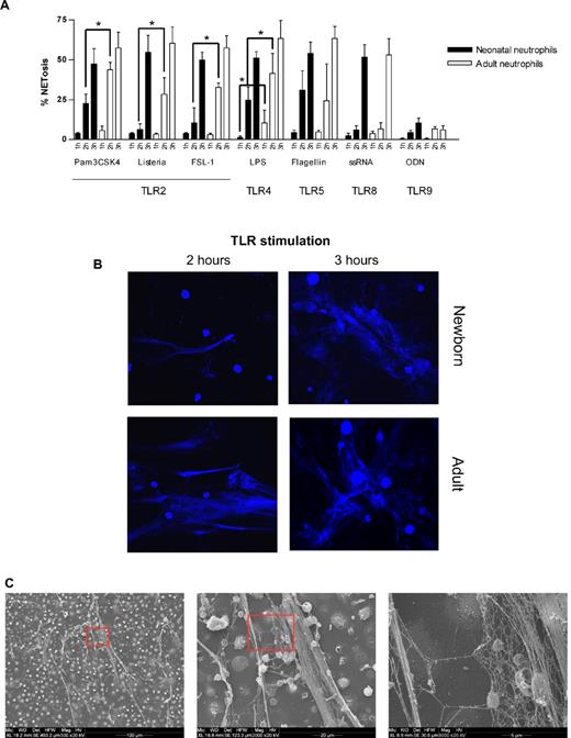 Figure 1. Neonatal NET formation. (A) Kinetics of NET formation by neonatal and adult neutrophils. Neutrophils were isolated from cord blood (n = 3) or peripheral adult blood (n = 3) by Percoll gradient centrifugation and erythrocyte lysis. Isolated neutrophils were stimulated with Pam3CSK4 (1 μg/mL), heat-killed Listeria monocytogenes (HKLM, 108/mL), FSL-1 (1 μg/mL), LPS (1 μg/mL), flagellin (1 μg/mL), ssRNA40 (1 μg/mL) or ODN2006 (2.5μM) for 1, 2, or 3 hours at 37°C. Afterward, NETosis was analyzed by DAPI (DNA staining) and citrullinated histone 3 staining and confocal microscopy. The percentage of NET-producing neutrophils was calculated from all neutrophils analyzed. *P < .05, neonatal versus adult NETosis. (B) Confocal laser scanning microscopy images of TLR-induced NETosis. Neutrophils were stimulated for 2 or 3 hours at 37°C with LPS (1 μg/mL). Blue channel indicates DNA (stained with DAPI) in stimulated neutrophils isolated from newborn and adult blood. (C) Scanning electron microscopy of neonatal NETosis. NETosis in neonatal neutrophils after LPS stimulation (1 μg/mL, 3 hours, 37°C) at 3 different magnifications. (D) Confocal laser scanning microscopy of histone citrullination. Neonatal neutrophils were stimulated with 1 μg/mL LPS for 3 hours at 37°C. Blue channel indicates DAPI; red channel, citrullinated histone 3; and green channel, F-actin. (E) Scanning electron microscopy of bacteria-induced NETosis. NET formation by neonatal neutrophils after coincubation with nonmucoid Pseudomonas aeruginosa (PAO.1) for 3 hours at 37°C. (F) Confocal light scanning microscopy of bacteria-induced NETosis. Neonatal neutrophils coincubated with nonmucoid P aeruginosa (PAO.1) for 3 hours at 37°C. Live/dead staining (BacLight bacterial viability kit, Invitrogen). Red channel indicates propidium iodide staining of extracellular DNA (NETs) and dead bacteria; green channel, Syto-9 stains live bacteria and intracellular DNA in the nuclei of living neutrophils; and yellow-red, overlay (dead bacteria). (B,D,F) Images were captured using an Olympus IX81 microscope (Fluoview 1000) and an Olympus XC30 camera, with Olympus Fluoview Software FV10-ASW 0.200, a 60×/1.35 oil objective, and Vectashield Mounting Medium. (C,E) Images were captured using an ESEM XL30 microscope (FEI, Philips; 20 kV).