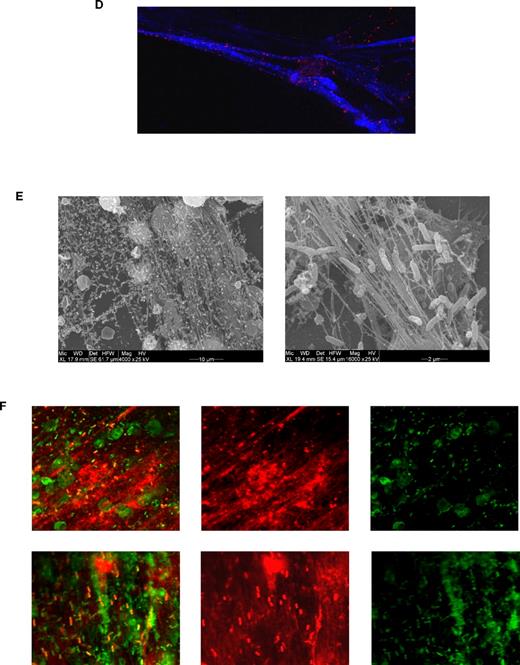 Figure 1. Neonatal NET formation. (A) Kinetics of NET formation by neonatal and adult neutrophils. Neutrophils were isolated from cord blood (n = 3) or peripheral adult blood (n = 3) by Percoll gradient centrifugation and erythrocyte lysis. Isolated neutrophils were stimulated with Pam3CSK4 (1 μg/mL), heat-killed Listeria monocytogenes (HKLM, 108/mL), FSL-1 (1 μg/mL), LPS (1 μg/mL), flagellin (1 μg/mL), ssRNA40 (1 μg/mL) or ODN2006 (2.5μM) for 1, 2, or 3 hours at 37°C. Afterward, NETosis was analyzed by DAPI (DNA staining) and citrullinated histone 3 staining and confocal microscopy. The percentage of NET-producing neutrophils was calculated from all neutrophils analyzed. *P < .05, neonatal versus adult NETosis. (B) Confocal laser scanning microscopy images of TLR-induced NETosis. Neutrophils were stimulated for 2 or 3 hours at 37°C with LPS (1 μg/mL). Blue channel indicates DNA (stained with DAPI) in stimulated neutrophils isolated from newborn and adult blood. (C) Scanning electron microscopy of neonatal NETosis. NETosis in neonatal neutrophils after LPS stimulation (1 μg/mL, 3 hours, 37°C) at 3 different magnifications. (D) Confocal laser scanning microscopy of histone citrullination. Neonatal neutrophils were stimulated with 1 μg/mL LPS for 3 hours at 37°C. Blue channel indicates DAPI; red channel, citrullinated histone 3; and green channel, F-actin. (E) Scanning electron microscopy of bacteria-induced NETosis. NET formation by neonatal neutrophils after coincubation with nonmucoid Pseudomonas aeruginosa (PAO.1) for 3 hours at 37°C. (F) Confocal light scanning microscopy of bacteria-induced NETosis. Neonatal neutrophils coincubated with nonmucoid P aeruginosa (PAO.1) for 3 hours at 37°C. Live/dead staining (BacLight bacterial viability kit, Invitrogen). Red channel indicates propidium iodide staining of extracellular DNA (NETs) and dead bacteria; green channel, Syto-9 stains live bacteria and intracellular DNA in the nuclei of living neutrophils; and yellow-red, overlay (dead bacteria). (B,D,F) Images were captured using an Olympus IX81 microscope (Fluoview 1000) and an Olympus XC30 camera, with Olympus Fluoview Software FV10-ASW 0.200, a 60×/1.35 oil objective, and Vectashield Mounting Medium. (C,E) Images were captured using an ESEM XL30 microscope (FEI, Philips; 20 kV).