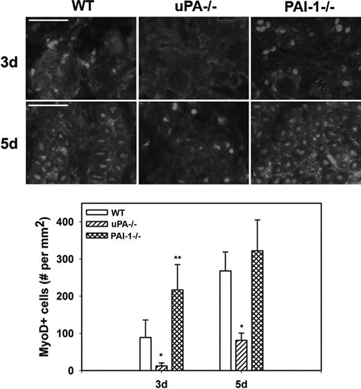 Figure 4. Myoblast accumulation after muscle injury in WT, uPA−/−, and PAI-1−/− mice. Muscles from WT, uPA−/−, and PAI-1−/− mice collected on days3 and 5 after cardiotoxin injury. (Top) Cryosections stained with antibody against the myoblast marker MyoD. Scale bar represents 50 μm. (Bottom) Number of nuclei staining positive for MyoD counted in 2 sections for each muscle, averaged, and expressed per square millimeter muscle area. Bars represent mean ± SE; n = 4 to 6 per time point. *Mean value significantly smaller than that for WT mice (P < .05). **Mean value significantly larger than that for WT mice (P < .05).