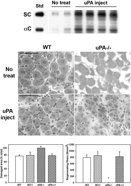 Figure 5. Administration of exogenous uPA to uPA−/− mice. uPA−/− mice were subjected to cardiotoxin muscle injury and either left untreated (No treat) or treated with intramuscular injection of exogenous uPA daily from 1 to 4 days after injury (uPA inject), and muscles collected at 5 days after injury. (Top) Muscle homogenates subjected to heparin sulfate affinity purification and then Western blotting for HGF. Note that treatment with exogenous uPA rescued HGF levels in muscle of uPA−/− mice. (Middle) Muscle cryosections stained with hematoxylin and eosin for morphologic analysis. Note the restoration of muscle regeneration in uPA−/− mice after treatment with uPA. Scale bar represents 50 μm. (Bottom) Quantitative analysis of morphology. WT indicates wild-type no treatment; WT-I, wild-type injected with uPA; uPA−/−, uPA−/− no treatment; and uPA−/−I, uPA−/− injected with uPA. Regenerating fibers identified as central nucleated fibers and counted in 2 sections per muscle and expressed as number per square millimeter muscle area. Damaged area estimated by subtracting summed area of normal and regenerating fibers from total muscle area. Bars represent mean ± SE; n = 4 to 6 per group. *Mean value significantly different from that for WT mice (P < .05).