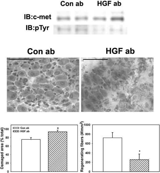 Figure 6. Administration of HGF-blocking antibody to WT mice. WT mice were subjected to cardiotoxin muscle injury and treated with intraperitoneal injection of either HGF-blocking antibody or control IgG daily, and muscles collected at 5 days after injury. (Top) Muscle homogenates subjected to c-met immunoprecipitation and then Western blotting for c-met or phosphotyrosine (pTyr). Note that treatment with HGF-blocking antibody reduced c-met phosphorylation. (Middle) Muscle cryosections stained with hematoxylin and eosin for morphologic analysis. Note the impairment of muscle regeneration in WT mice after treatment with HGF-blocking antibody. Scale bar represents 50 μm. (Bottom) Quantitative analysis of morphology. Regenerating fibers identified as central nucleated fibers and counted in 2 sections per muscle and expressed as number per millimeter muscle area. Damaged area estimated by subtracting summed area of normal and regenerating fibers from total muscle area. Bars represent mean ± SE; n = 4 to 6 per group. *Mean value significantly different from that for WT mice (P < .05).