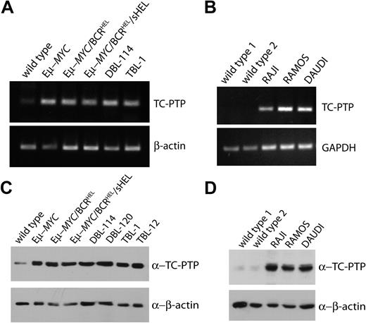 Figure 1. TC-PTP is overexpressed in mouse and human B-cell lymphomas. (A) TC-PTP mRNA expression in murine model lymphomas. Total mRNA was extracted from wild-type splenocytes, 3 different primary MYC-driven B-cell lymphomas, and DBL-114 and TBL-1 mouse B-cell lymphoma cell lines. cDNA was prepared and PCR was performed using primers specific to TC-PTP or β-actin, as a control. (B) TC-PTP expression in human BL cell lines. As in panels A and B, total mRNA was extracted from wild-type human B cells and 3 different BL cell lines: RAJI, RAMOS, and DAUDI. PCRs for human TC-PTP and GAPDH were then performed and analyzed by gel. Representative gels of at least 3 repeats. (C) TC-PTP protein expression in murine model lymphomas. TX-100 detergent lysates from purified splenic B cells, primary MYC-driven mouse B-cell lymphomas, and mouse B-cell lymphoma cell lines (DBL-114, DBL-120, TBL-1, and TBL-12) were probed with 6F3 anti-TCPTP and anti–β-actin. Representative blot; each sample was blotted 4 times. (D) TC-PTP protein expression in human BL cell lines. As in panel C, TX-100 protein lysates of wild-type human B cells and 3 different BL cell lines (RAJI, RAMOS, and DAUDI) were probed with CF4-1D anti–human TCPTP and anti–β-actin. Representative blot from a pool of 4.