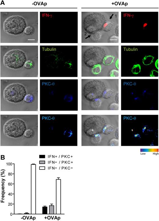 Figure 4. CD4+ T cells polarize their secretory machinery toward IFN-γ/IL-4–primed PCMCs. IFN-γ/IL-4–primed PCMCs were pulsed or not with 10 μg/mL OVAp. After washing, APCs were cocultured with effector OT-II T cells for 10 minutes. Cells were settled onto polylysine-coated slides; fixed; and stained for tubulin, PKCθ, and IFN-γ; and analyzed by confocal laser scanning microscopy. (A) Representative staining for IFN-γ (red), tubulin (green), and PKCθ (blue) of a PCMCIFN-γ/IL-4/OT-II T-cell conjugate, each staining is represented alone or merged with DIC images; PKCθ staining is also shown as pseudocolor intensity. Arrow 1 points to a synapse where IFN-γ is polarized toward the PCMCs and PKCθ is enriched at the OT-II T cell/PCMC contact site; arrow 2 points to a synapse where PKCθ only is enriched. (B) OT-II T-cell/PCMC conjugates were randomly selected and scored for the recruitment of PKCθ to the cell–cell contact site either alone or in combination with IFN-γ polarization. indicates conjugates exhibiting recruitment of PKCθ alone; ■, conjugates exhibiting polarization of both PKCθ and IFN-γ; □, conjugates exhibiting neither PKCθ nor IFN-γ polarization. Approximately 100 conjugates were analyzed per experiment. Histograms represent means ± SEM of 3 independent experiments. Bar = 5μm.