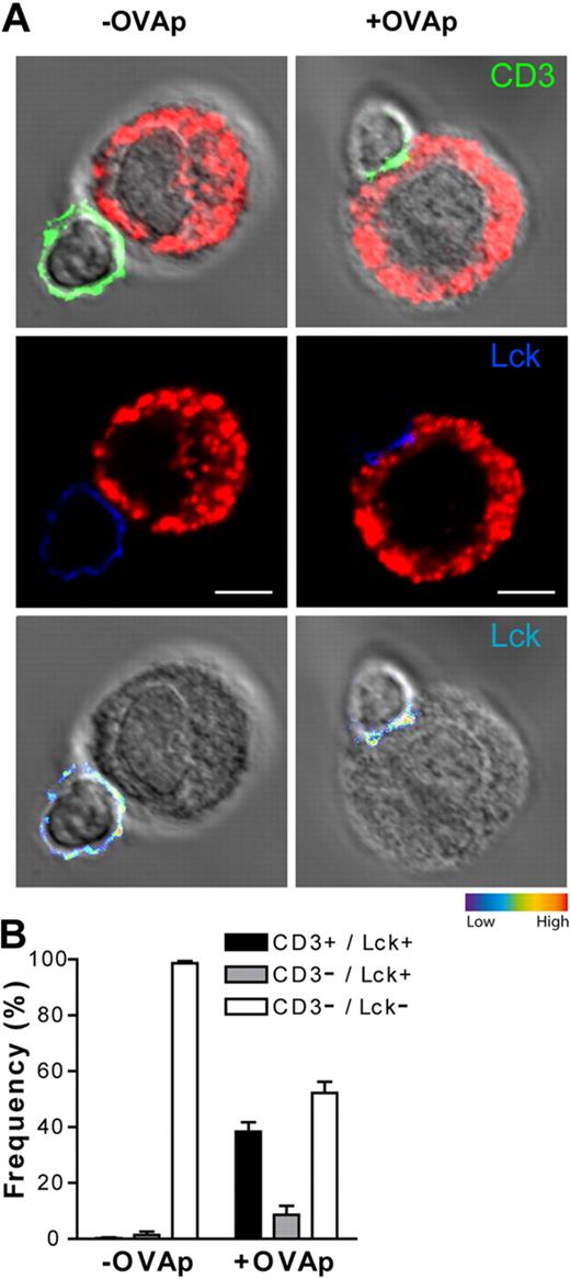 Figure 5. Enrichment of TCR/CD3 complex and of p56lck at the T cell/PCMCIFN-γ/IL-4 contact site. IFN-γ/IL-4–primed PCMCs were pulsed or not with 10 μg/mL OVAp. After washing, APCs were cocultured with effector OT-II T cells for 10 minutes. Cells were settled onto polylysine-coated slides, fixed, and stained for mast cell granules with avidin-sulforhodamine 101 (red), CD3ϵ (green), and p56lck (blue). (A) Representative staining for CD3ϵ (green), and p56lck (blue) of a PCMCIFN-γ/IL-4/OT-II T-cell conjugate. Staining is represented merged with DIC images; p56lck staining is also shown as pseudocolor intensity. (B) OT-II T cell/PCMC conjugates were randomly selected and scored for the recruitment of p56lck to the cell-cell contact site either alone or in combination with CD3ϵ. indicates conjugates exhibiting recruitment of p56lck alone; ■, conjugates exhibiting polarization of both p56lck and CD3ϵ; □, conjugates exhibiting neither p56lck nor CD3 polarization. Approximately 100 conjugates were analyzed per experiment. Histograms represent means ± SEM of 3 independent experiments. Bar = 5μm.
