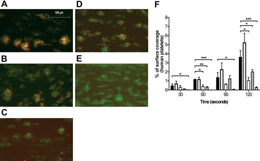 Figure 1. Human platelets incorporate into NOD/SCID mouse thrombi. (A-F) Washed human platelets (5% of the total platelet population) were mixed with anticoagulated whole blood from NOD/SCID mice, incubated without (A) or with moAbs 24B3 (B), 6B4 (C), 16N7C2 (D), or 6B4 + 16N7C2 (E; 10 μg/mL each) and perfused at 1500 seconds−1 over coverslips coated with collagen (200 μg/mL). Murine and human platelets were labeled with anti-mouse CD42c-Alexa 488 and anti-human CD61-PE, respectively. (F) Surface covered by human platelets, expressed as the percentage of the total surface observed, was calculated at the indicated perfusion times. Data represent mean ± SEM (n = 3 for each group). Statistical analysis was performed using unpaired Student t test. *P < .05; **.001 < P < .05; ***P < .001. Control (■), 24B3 (), 6B4 (□), 16N7C2 (▩), 6B4 + 16N7C2 (▨). Mouse platelets in control PB represented 20.8% ± 2.5% of the total surface coverage (mean ± SEM of 9 fields, n = 3), and was not significantly different from moAb-treated PB (> 5 fields, n = 3).