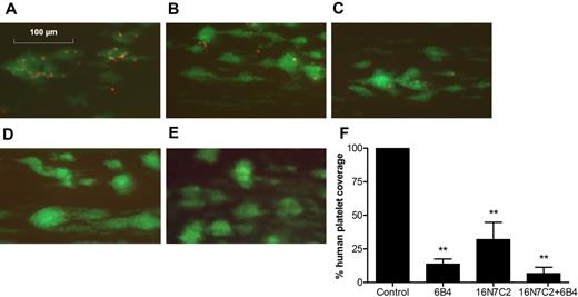 Figure 4. Human platelets issued from CD34+-progenitor cells incorporate into NOD/SCID mouse thrombi. (A-D) Representative images of murine/human thrombi from CD34+-transplanted NOD/SCID mouse-anticoagulated PB incubated without (A) or with 10 μg/mL moAbs 6B4 (B), 16N7C2 (C), or 6B4 + 16N7C2 (D, 10 μg/mL each) after 2 minutes of perfusion over collagen-coated coverslips (200 μg/mL) at 1500 seconds−1. Human platelets, representing 2.1% of the total platelet population, and murine platelets were stained with anti–human CD61-PE and anti–mouse CD42c-Alexa 488, respectively. (E) PB from nontransplanted mouse. (F) Surface coverage by human platelets from untreated, transplanted NOD/SCID PB was calculated at the end of each perfusion experiment and compared with the same transplanted NOD/SCID PB incubated with moAbs. Data represent mean values ± SEM (n ≥ 3 for each group). Statistical analysis was performed using paired Student t test (**.001 < P < .05).