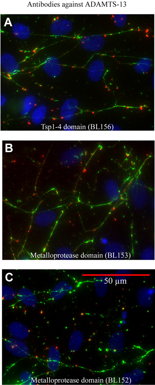Figure 4. HUVEC-released ADAMTS13 attached to HUVEC-secreted VWF strings. HUVECs were stimulated with histamine for 2 minutes, washed, and incubated for 20 minutes (without fixative) with polyclonal goat antibodies made against different domains of human ADAMTS-13: (A) BL156 (Tsp1-4 domain); (B) BL152 (metalloprotease domain); and (C) BL153 (distinct peptide within metalloprotease domain); and secondary anti-goat IgG-594 (red). The cells were rewashed before staining with rabbit anti–VWF plus anti-rabbit IgG-488 (green) to visualize VWF strings. Cell nuclei were stained blue with DAPI. The images magnified ×600, represent 6 to 12 experiments, and demonstrate that blocking the activity of HUVEC-released ADAMTS-13 enables the ADAMTS-13 bound only to uncleaved VWF strings to be detected.
