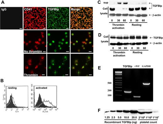 Figure 1. Secretion of TGFBIp from activated human platelets and TGFBIp binding on activated platelet surfaces. (A) TGFBIp exists in platelets. Washed platelets were allowed to adhere on fibronectin and were stained with anti-CD41 (red) and anti-TGFBIp (green) antibodies. Attached platelets and TGFBIp expression were observed under a fluorescence microscope. (Top) Low magnification (×400; white bar represents 10 μm). (Middle and bottom) High magnification (×1000; white bar represents 5 μm). (B) TGFBIp on resting (left) and thrombin-activated (right) platelet surfaces was detected by FACS analysis. Black shading denotes immunoglobulin G control, and the gray line denotes TGFBIp. Presence of TGFBIp in resting and activated platelets (thrombin activation) was analyzed by immunoblotting. Washed platelets were incubated with (C) or without stirring (D), during which they were activated by thrombin. Cell (cell lysate) and supernatant (sup) were separated by centrifugation at 18 000g and were immunoblotted by anti-TGFBIp antibody. β-actin was loaded as a control. (E) TGFBIp mRNA exists in platelets. Total RNA was isolated and subject to RT-PCR for the analysis of TGFBIp, VWF, and GAPDH mRNA expression. (F) Measurement of the amount of TGFBIp in platelets. The amount of TGFBIp in platelets was semiquantitatively measured by Western blot analysis.