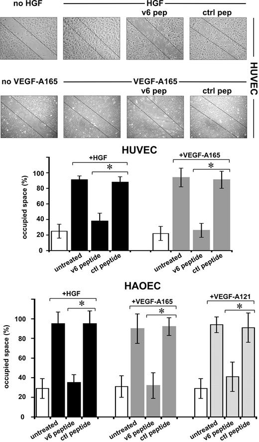 Figure 5. Migration of ECs requires CD44v6. An example of a scratch assay (see “Scratch assay”) with HUVECs and the quantification with HUVECs and HAOECs treated with growth factors and peptides as indicated are shown. SD was calculated from 3 independent experiments. *P < .05.