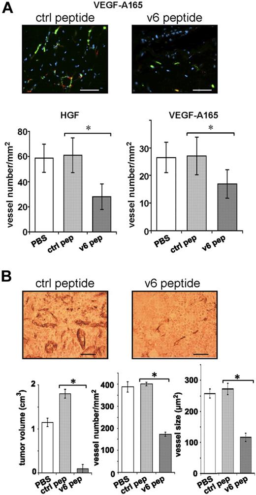 Figure 7. The formation of a vasculature in vivo requires CD44v6. (A) A spheroid-based in vivo angiogenic assay was performed as described in “In vivo angiogenesis assay.” Growth factor and peptide treatments are indicated. Two representative pictures of blood vessels in plugs are shown. Bars represent 50 μm. Staining of blood vessels was performed with CD34 antibody (green); red indicates smooth muscle actin staining (including pericytes; Sigma-Aldrich). Nuclei were stained with Hoechst dye 33258 (blue; Sigma-Aldrich). A minimum of 3 different plugs per condition were analyzed and quantified by immunologic staining (“Immunohistologic analysis”). (B) L3.6pl human pancreatic cancer cells were injected orthotopically into male nude mice as described.18 Three groups of 5 mice each were injected 7 days later with PBS or control peptide (20 μg) or CD44 v6 peptide (20 μg). Injection was repeated 3 times per week. Animals were killed 21 days after the beginning of the treatment. Tissues were stained with the endothelial marker CD31 (“Immunohistologic analysis”). A representative staining is shown. Bars represent 50 μm. Tumor volume, vessel number, and average vessel size were determined and evaluated in the graphs. All animals were handled according to German regulations for animal experimentation. The animal experiments were approved by the Regierungspäsidium Karlsruhe (35-9185.81/G-83/04). All mice were obtained from Harlan.