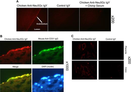 Figure 1. Detection of Neu5Gc in aortic endothelium of human autopsy samples and microvasculature of colon and placenta. The chicken anti-Neu5Gc antibody (cGcAb) was used to detect the presence of Neu5Gc on the endothelium of autopsy samples of normal-appearing human aorta. Typical representatives of 8 autopsy samples studied are shown. The red Cy3 fluorescence represents labeling of endothelial cells of the aorta. (A) Specificity of the antibody was demonstrated by the lack of signal with the nonimmunized control chicken IgY (middle) and the abrogation of signal by adsorption with Neu5Gc-rich glycoproteins of chimpanzee serum (right). Magnification ×200. (B) Sections were double-stained with anti-CD31 for endothelial cells and counterstained with DAPI to visualize nuclei (magnification ×1000). (C) Sections of placenta (top) and colon (bottom) stain for Neu5Gc along microvasculature endothelial lining with the use of cGcAb. Control IgY (right) demonstrates specificity of signal (magnification ×200).