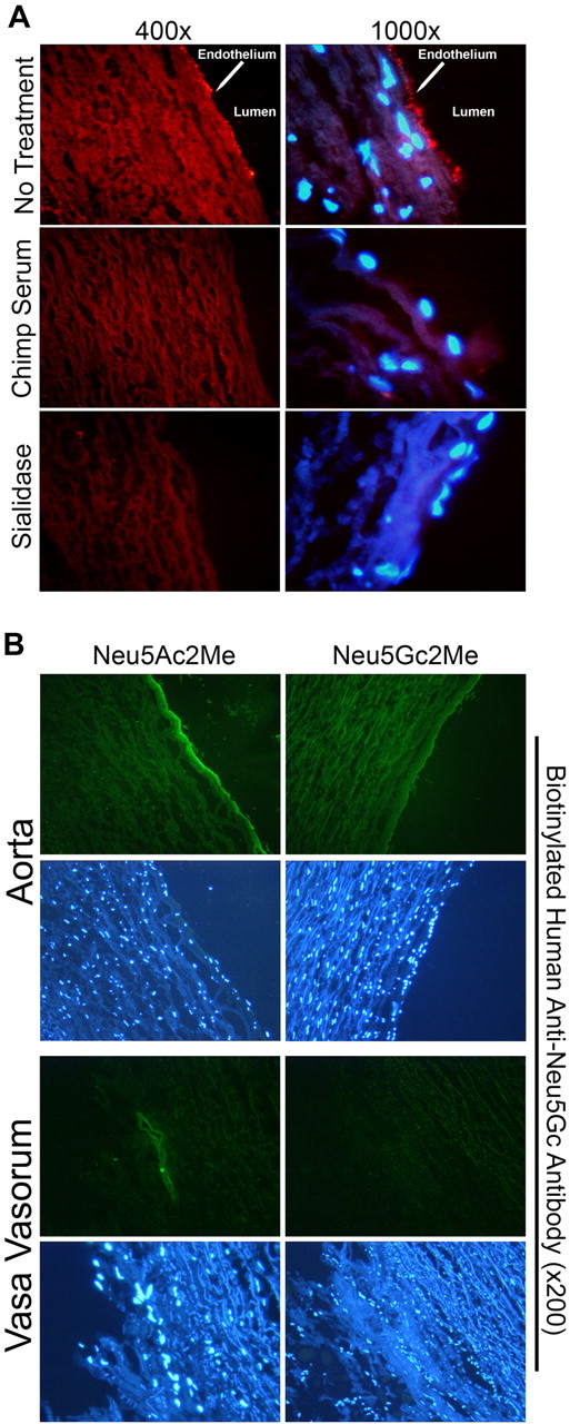 Figure 2. Affinity-purified human anti-Neu5Gc antibodies bind specifically to Neu5Gc on endothelial cells of aorta sections and vasa vasorum. Affinity-purified human anti-Neu5Gc antibodies were used as a primary reagent on cryosections of autopsy samples of aorta. (A) Sections were incubated with the biotinylated, affinity-purified human anti-Neu5Gc antibodies followed by rabbit anti-biotin and then Cy3-anti-rabbit, with nuclear counterstaining using DAPI (top). Antibody staining was abrogated by adsorption with chimpanzee serum (middle) or by previous sialidase pretreatment (bottom). A representative example of 5 independent experiments is shown. (B) Sections were incubated with biotinylated, affinity-purified human anti-Neu5Gc antibodies followed by mouse anti-biotin and FITC antimouse antibody and nuclear counterstaining with DAPI. Primary antibody staining was abrogated by addition of Neu5Gc2Me but not by Neu5Ac2Me. The staining pattern is appreciated in both aorta and vasa vasorum. A representative example of 3 independent experiments on 8 individuals is shown (magnification ×200).