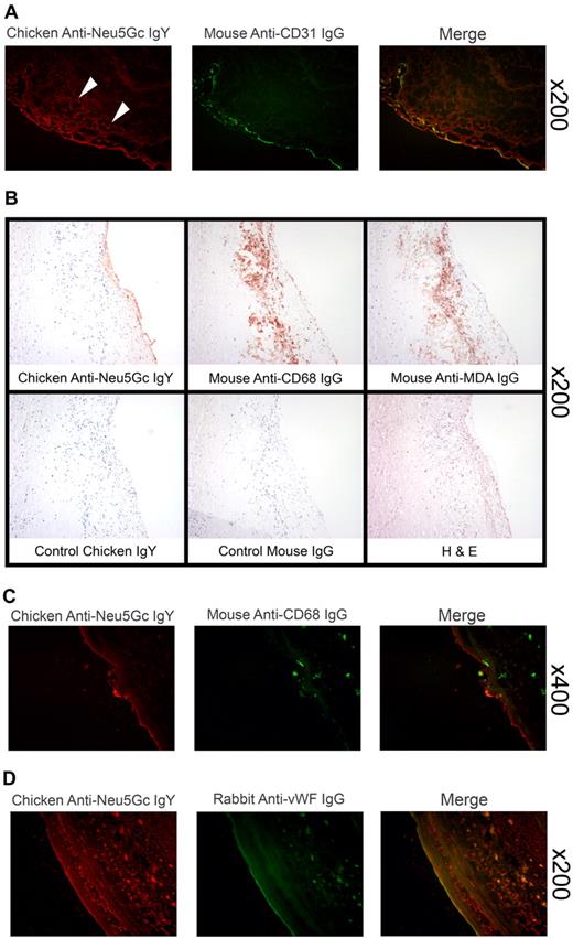 Figure 5. Neu5Gc in the endothelium and subendothelium of atherosclerotic plaques. (A) Expression of Neu5Gc in endothelium overlying human aortic atherosclerotic plaques is shown by double labeling with the cGcAb anti-Neu5Gc antibody (left) the endothelial marker CD31 (center, see merge, right). White arrows indicate subendothelial Neu5Gc within lesions (left). (B) Samples of human aortic atherosclerotic plaques were identified by their characteristic appearance (hematoxylin and eosin, bottom right). Accumulation of macrophages (stained with anti-CD68, top middle) and oxidized-LDL (stained with malondialdehyde, top right) are shown. The cGcAb (top left) was used to detect the presence of Neu5Gc on the endothelium of the plaques. Control IgY and mouse IgG (bottom right and middle) demonstrates specificity of the staining. (C) Human aortic atherosclerotic plaque sections were double-stained with anti-CD68 (middle) for macrophages and cGcAb (left) for Neu5Gc. The merged fluorescent image (right) indicates that macrophages are recruited to the Neu5Gc-lined endothelium. (D) Endothelium was labeled with anti-VWF antibody (center; note that there is also some subendothelial green auto-fluorescence caused by macrophages and/or necrotic foci). In addition to typical endothelial-colocalized Neu5Gc staining, extensive subendothelial labeling with the cGcAb anti-Neu5Gc antibody (red channel, left) is seen in this lesion (see yellow in the merged image, right). All pictures in this figure are representative examples of multiple independent analyses on multiple samples from multiple individuals.