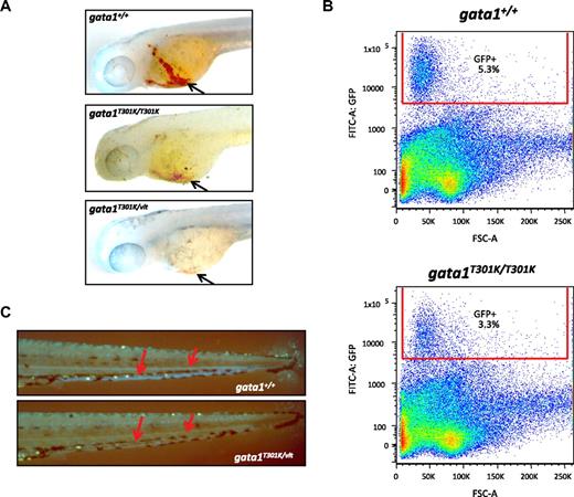Figure 2. Effect of lower Gata1 DNA binding activity on erythropoiesis in gata1T301K/vlt and gata1T301K/T301K embryos. (A) o-dianisidine staining for hemoglobin (black arrows) to show the reduction or absence of erythrocytes in gata1T301K/T301K (n = 10/10) and gata1T301K/vlt (n = 10/10) embryos, respectively, compared with the wild-type (n = 0/20) embryos at 2 dpf. (B) Percentage of GFP+ cells in 3 dpf wild-type and gata1T301K/T301K embryos carrying Tg(gata1:GFP). Fifty to 60 embryos from each genotype were pooled, dissociated, and subjected to flow cytometric analysis. gata1T301K/T301K embryos showed a 38% reduction in the percentage of GFP+ cells compared with the wild-type. (C) Tg(gata1:GFP) as a marker for erythrocytes (red arrows point to the GFP+ cells seen in circulation) to show the absence of erythrocytes in the gata1T301K/vlt embryo (bottom, n = 25/25) compared with the wild-type embryo (top, n = 0/30) at 4 dpf. Original magnification ×50 (A,C).
