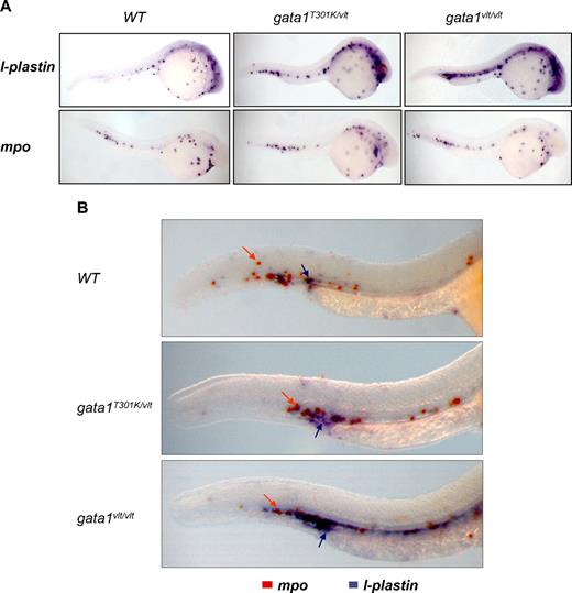 Figure 5. Gata1 DNA binding level–dependent myeloid expansion. Lateral views of whole embryos with the head to the right and dorsal to the top. (A) Expression pattern of the myeloid markers l-plastin and mpo in 24-26 hpf gata1T301K/vlt (l-plastin, n = 9/9; mpo, n = 5/5), gata1vlt/vlt (l-plastin, n = 2/2; mpo, n = 5/5), and wild-type embryos (l-plastin, n = 6/6; mpo, n = 7/7) showing an expansion of l-plastin expression in the gata1 mutant embryos. (B) Double in situ hybridization showing l-plastin (purple staining, indicated by purple arrows) and mpo (orange staining, indicated by orange arrows) in the ICM/AGM regions of 26-30 hpf gata1T301K/vlt (n = 4/4), gata1vlt/vlt (n = 12/12) and wild-type (n = 12/12) embryos. Original magnifications ×50 (A) and ×115 (B). Individual embryos were imaged and genotyped by PCR followed by Taq1 digestion (vlt) or sequencing (T301K).