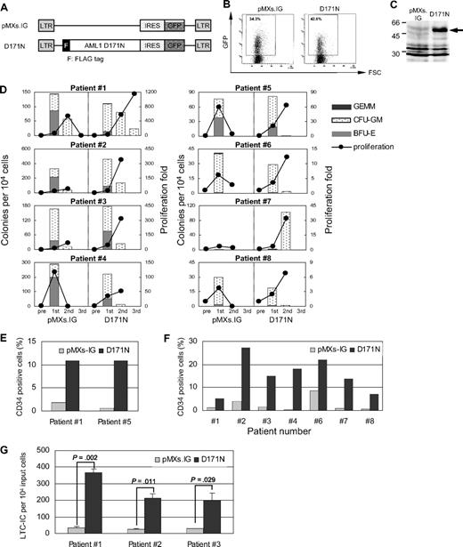 Figure 1. Retroviral transduction of CD34+ cells from patients with MPN. (A) pMXs.IG retroviral construct to express AML1 D171N. LTR indicates long terminal repeat. The FLAG-tagged D171N mutant was inserted into a retrovirus vector plasmid that encoded IRES-GFP. (B) Transduction of the AML1 D171N mutant into CD34+ cells obtained from patients with MPN. CD34+ cells were isolated from 8 patients with PV (nos. 1 and 2), ET (no. 3), PMF (no. 4), MPN-unclassified (nos. 5 and 6), post-PV MF (no. 7), and post-ET MF (no. 8). The cells were transduced either with a control vector (pMXs.IG) or with the AML1 mutant (D171N). A typical flow cytometric profile of cells transduced with either pMXs.IG or D171N retrovirus. The efficiency of retrovirus transduction was 30% to 50%. The GFP+ cells shown within the gate were collected. (C) Anti-FLAG immunoblotting of sorted GFP+ cells to confirm the expression of FLAG-tagged AML1 D171N protein. (D) Colony number and cell proliferation from CFC replating assays. The experiment was performed twice for patient nos. 6 and 7 and once for other patients. Shown are representative data for 8 of 13 patients. After 14 days of culture in methylcellulose, plates of cells from the patients with PV, ET, and PMF (nos. 1-4) contained more than 100 colonies, whereas those from patients with MPN-unclassified and post-PV/ET MF (nos. 5-8) contained only 1 to 80 colonies. Note that the y-axis scales vary. BFU-E indicates burst-forming unit-erythroid; CFU-GM, colony-forming unit-granulocyte, macrophage; GEMM, colony-forming unit-granulocyte, erythroid, macrophage, megakaryocyte. (E) Percentage of CD34+ cells in total cells recovered from the first CFC plates 14 days later. (F) Percentage of CD34+ cells in the cells cultured on MS5 stroma cells for 5 weeks. MS5 cells were excluded by flow cytometry gating. (G) The retrovirus-transduced and sorted cells were cultured on MS5 cells for 5 weeks and subjected to subsequent CFC assays. LTC-IC assays were carried out in triplicate, and the average numbers of LTC-ICs per 10 000 original input cells and SDs are indicated.