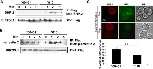 Figure 5. KIR2DL1 alleles *00401 and *010 showed different signaling intensity and inhibition of lipid raft polarization at immune synapse upon stimulation with 721.221-Cw6 cells. YT-Indy cells were retrovirally transduced with KIR2DL1 alleles *00401 and *010 fused with FLAG tag. Similarly expressing cells were collected by flow cytometry cell sorting. YT-Indy cells expressing FLAG-tagged KIR2DL1 alleles *00401 and *010 were stimulated with target 721.221-Cw6 cells at a 1:2 (E/T) ratio for the indicated times. The stimulated cells were lysed and immunoprecipitated (IP) with anti-FLAG antibody, followed by immunoblotting (IB) with antibodies to (A) SHP-2 and (B) β-arrestin 2. Membranes were stripped and reprobed with FLAG antibody for loading control. (C) Positive and negative are representatives of lipid raft polarization and inhibition of lipid raft polarization, respectively. 2DL1 indicates cells stained with KIR2DL1 antibody, GM1 for lipid raft, and BF for conjugate formation. Calculated percentages of lipid raft polarization in YT-Indy/KIR2DL1*00401401 and YT-Indy/KIR2DL1*010010 in the presence of 721.221-Cw6 are shown in the lower panel. Images were obtained by a Nikon Eclipse E800 fluorescence microscope. The experiment was repeated 3 times. **P < .05. Error bars represent SD.