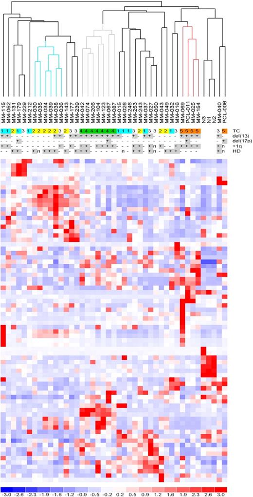 Figure 1. Unsupervised analysis of miRNA expression profiles. Hierarchical clustering of the samples using the 74 most variable miRNAs (patients in columns, miRNAs in rows). The color scale bar represents the relative miRNA expression changes normalized by the standard deviation. The patients' molecular characteristics are shown above the matrix; n indicates unavailable information. Specific characteristics are enriched in colored sub-branches.