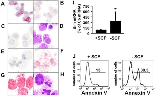 Figure 1. Immunocytochemical detection of Bim in normal bone marrow cells and mast cells. (A) Mononuclear cells obtained from normal bone marrow (BM); (B) neoplastic mast cells (MCs) obtained from the BM of a patient with ASM; and (C) neoplastic MCs obtained from the BM of a patient with MCL. Immunocytochemistry was performed using an antibody against Bim. (D) Wright-Giemsa staining of neoplastic MCs in a patient with MCL. (E-F) Cord blood–derived cultured MCs were kept in SCF, 100 ng/mL (E) or were starved from SCF (F) for 5 days (37°C). Then, cells were harvested, spun on cytospin slides, and stained with an anti-Bim antibody. (G-H) Tryptase stain (G) and Wright-Giemsa stain (H) of cultured cord blood–derived MCs kept in SCF. Figures shown in panels A through H (magnification, ×400 each) were prepared using an Olympus DP11 camera connected to an Olympus BX50F4 microscope equipped with 100×/1.35 UPlan-Apo objective lens (Olympus). Images were prepared using Adobe Photoshop CS2 software Version 9.0 (Adobe Systems) and processed with PowerPoint software (Microsoft). (I) Real-time PCR performed on cultured cord blood–derived mast cells kept in medium with (+SCF) or without (−SCF) SCF for 2 days. PCR was performed using primers specific for Bim and ABL. Expression of Bim mRNA is expressed as percentage of control (= ABL mRNA levels = 100%) and represents the mean ± SD of 6 independent experiments. *P < .05. (J) Apoptosis-inducing effect of SCF starvation on cultured cord blood–derived MCs. MCs were kept in the presence (+SCF, left panel) or absence (−SCF, right panel) of 100 ng/mL SCF for 5 days, and then were subjected to annexin V staining and flow cytometry.